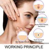 Acne Pimple Patch Absorbing Hydrocolloid Invisible Acne Patch For Face Zit with Tea Tree oil
