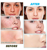 Turmeric Kojic Acid Exfoliating Cleansing Pads