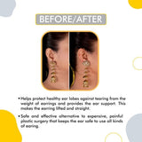 SlickFix Ear Lobe Tape (Pack of - 100/200) Invisible Ear Lobe Support Patch for Heavy Earrings & Long Time Wearing Earrings, Clear